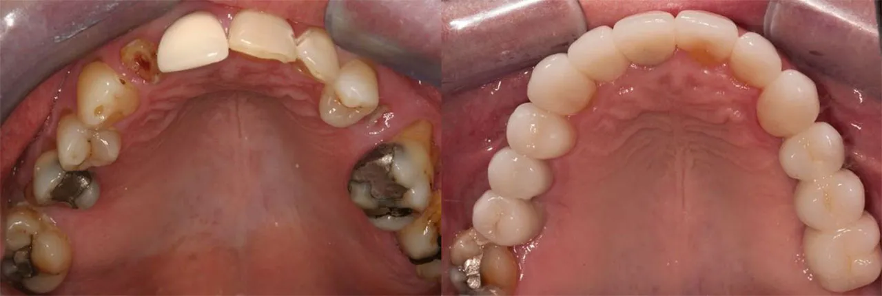 Full Mouth Reconstruction Greater Kalamazoo