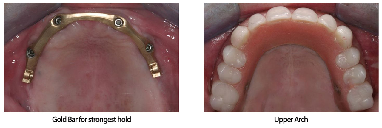 Mouth Reconstruction Dentist Near You