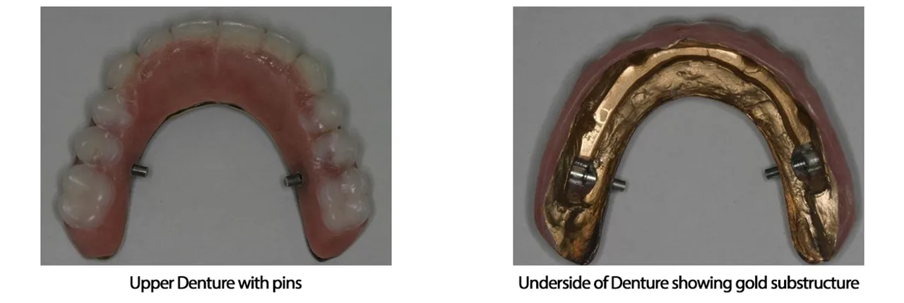 Mouth Reconstruction Dentists West Michigan