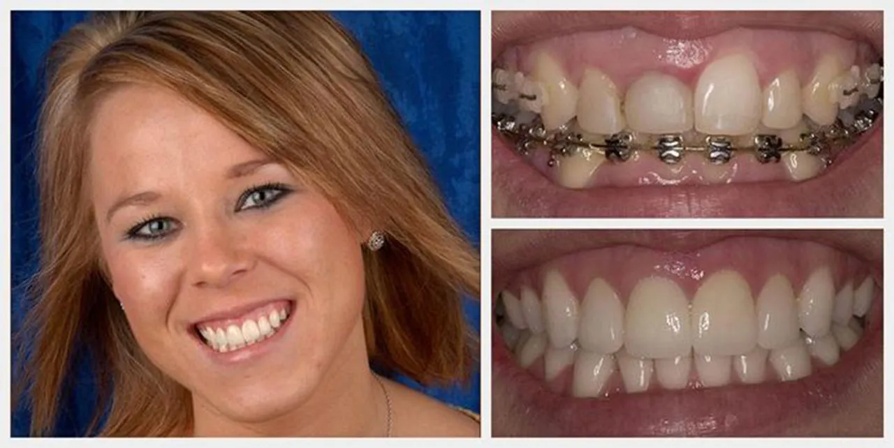 Mouth Restoration Dentist Portage Mi