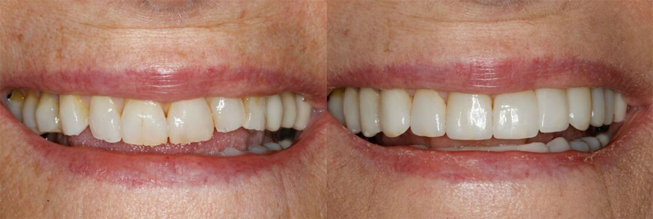 Smile Makeover Dentists Near You