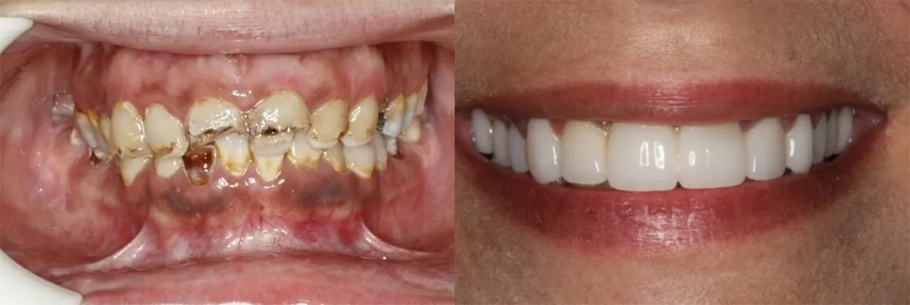 Smile Restoration Dentists Portage Michigan