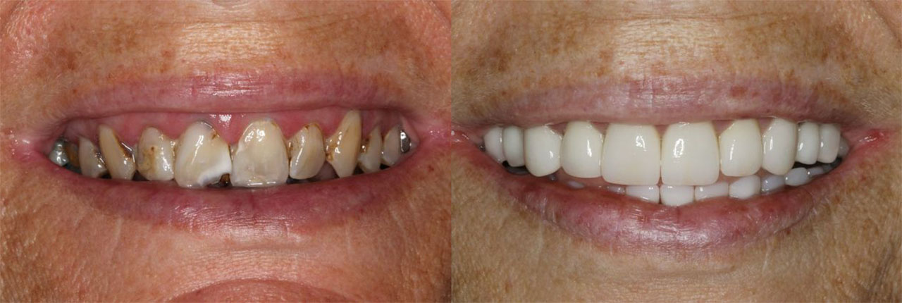 West Michigan Mouth Reconstruction Dentists